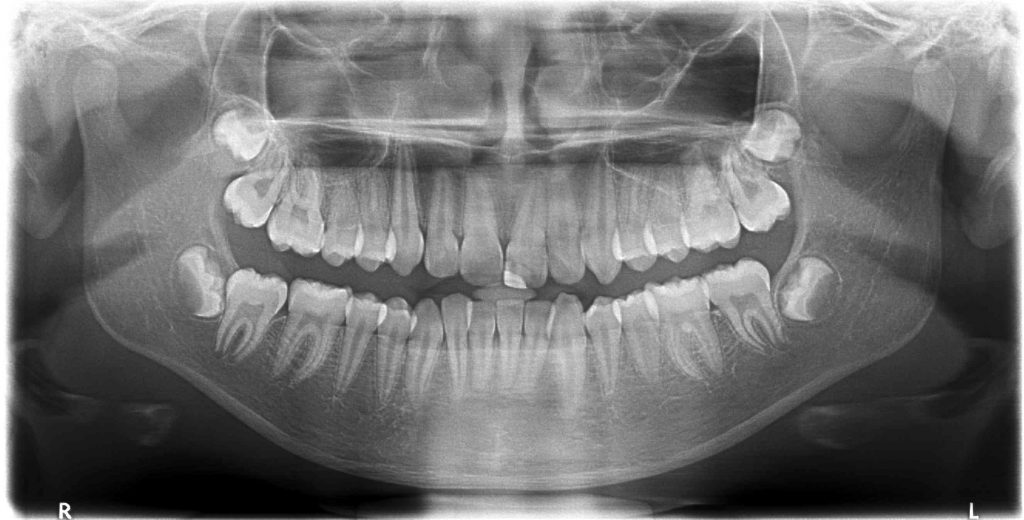 Panoramic x-ray – Mediatrix